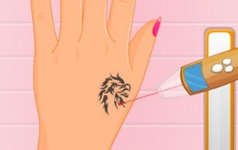 Laser Tattoo Removal